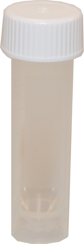 Cerebrospinal Fluid (CSF)